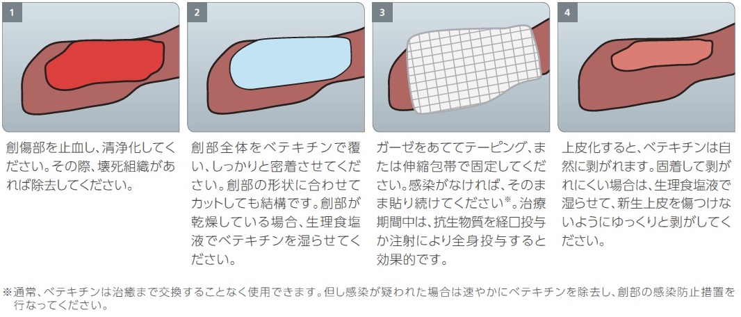 ユーザが追加した画像