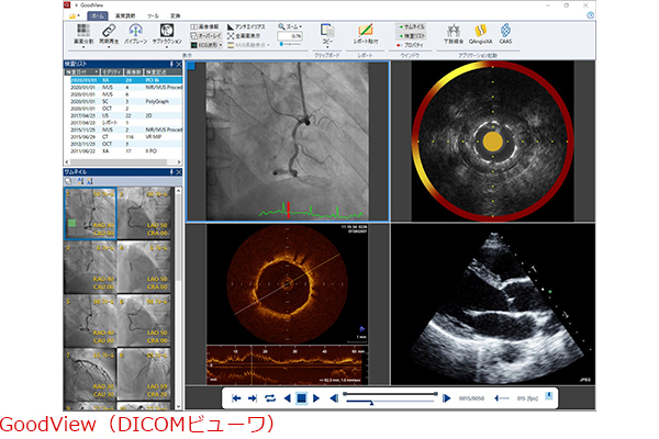 Multiframe DICOM PACS：Goodnetの写真