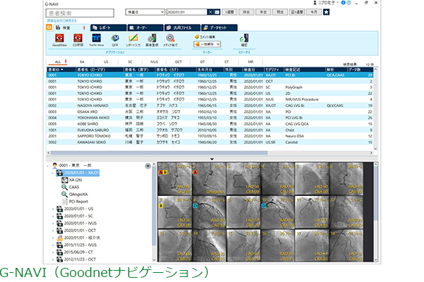 Multiframe DICOM PACS：Goodnetの写真
