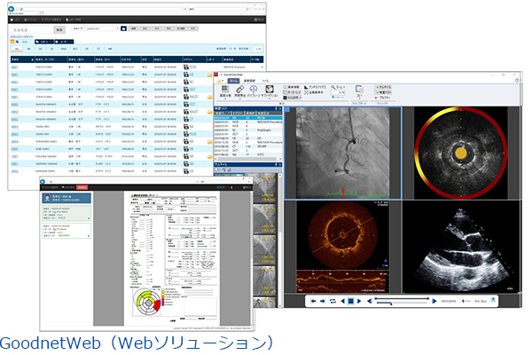 Multiframe DICOM PACS：Goodnetの写真