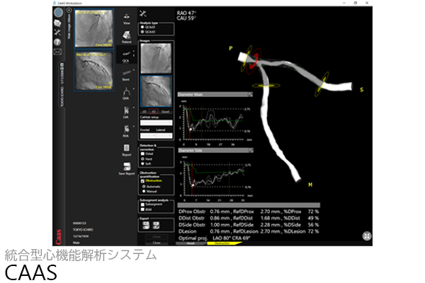 解析アプリケーションの写真